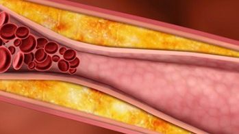 Sucuri și ceaiuri care "curăță" vasele de sânge