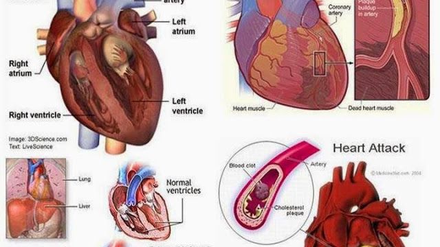 Semne care te ajută să anticipezi instalarea unui atac de cord. Chiar şi cu o lună înainte