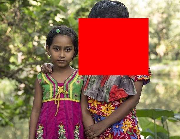 Povestea cutremurătoare a tinerei fără faţă: nici nu ştie dacă are ochi şi nas. "Sunt fericită aşa!"