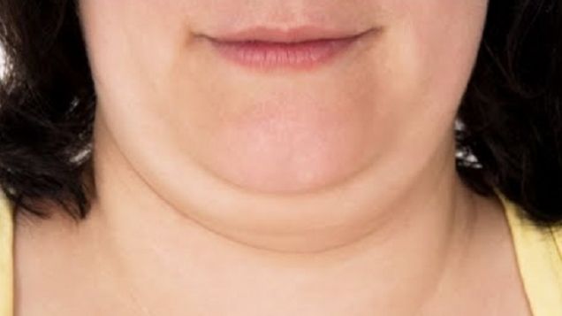 Cum să scapi de bărbia dublă. Cele mai eficiente exerciții