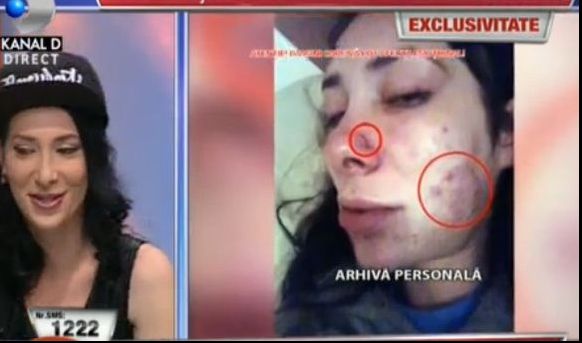 Membru al unei trupe din România și-ar fi mutilat iubita. A fost nevoie de intervenția poliției