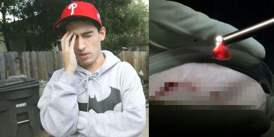 Şocul medicilor, după ce un tânăr student s-a plâns de dureri de cap. Ce au găsit în creierul său