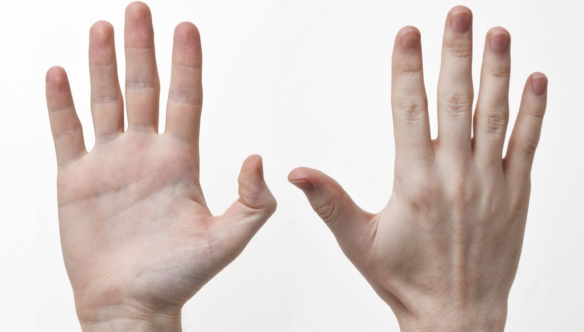 Simptomele cancerului apar prima dată pe mână. Cum arată