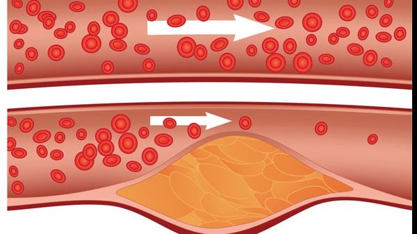 Vrei să reduci nivelul colesterolului? Mănâncă zilnic acest aliment