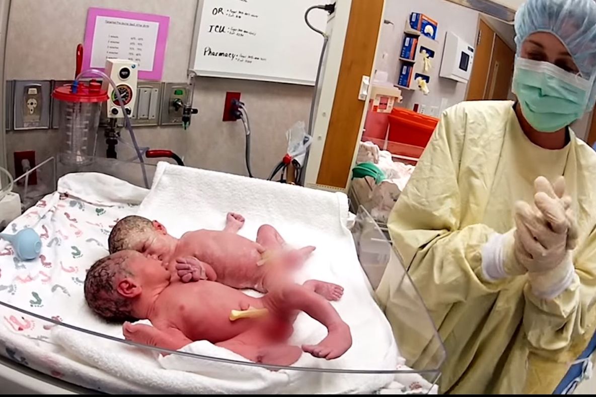 Gemenii nou-născuți s-au oprit din plâns numai după ce medicii au făcut asta. E uimitor!
