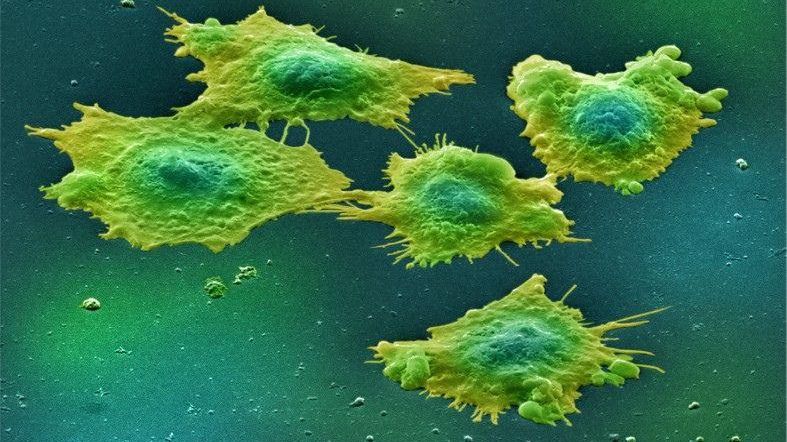 S-a descoperit: alimentul acesta provoacă patru tipuri de cancer. Renunţi la el?