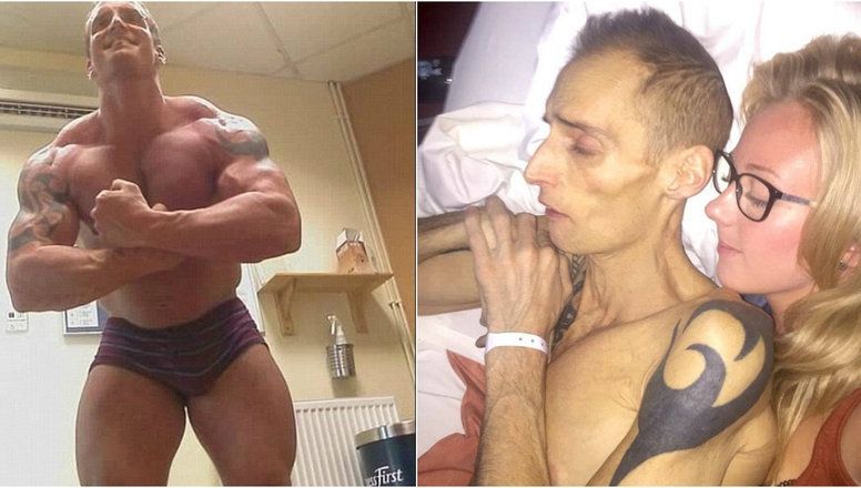 Era sportiv și sănătos tun, dar a slăbit brusc și a murit. Medicii au aflat de ce și au rămas șocați