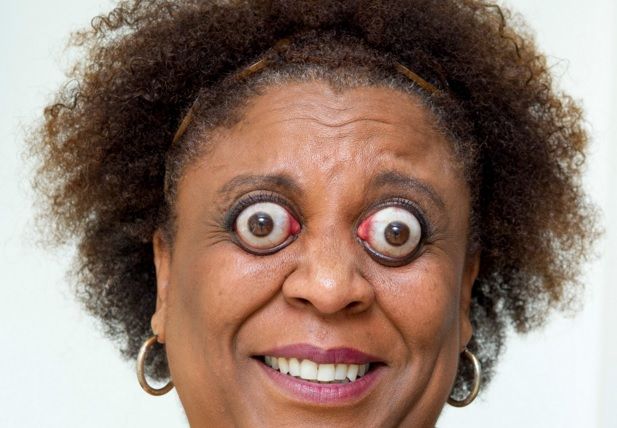 Incredibil! Aceşti oameni trăiesc printre noi. Cei mai ciudaţi de pe Planetă. Fizicul lor, oripilant