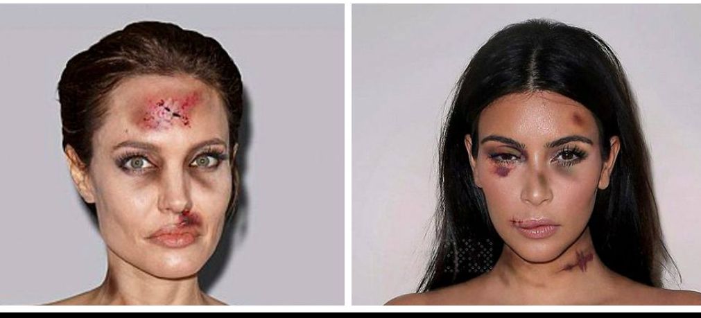Imaginile care au îngrozit internauții. Angelina Jolie și Kim Kardashian, bătute și învinețite   