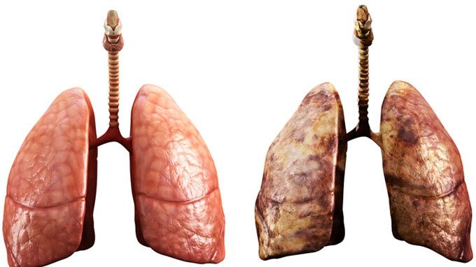 Testul care îţi spune dacă ai probleme cu plămânii. Mergi urgent la doctor dacă nu poţi să-l faci