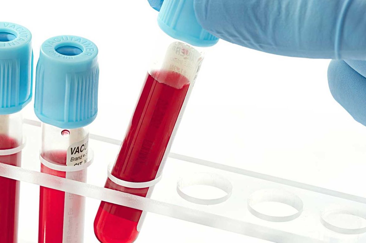 Cum te comporți cu cei din jur, în funcție de grupa de sânge