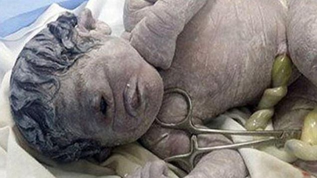 Expusă radiațiilor în timpul sarcinii, a sperat că va fi bine. Ce a născut la final..e dramatic