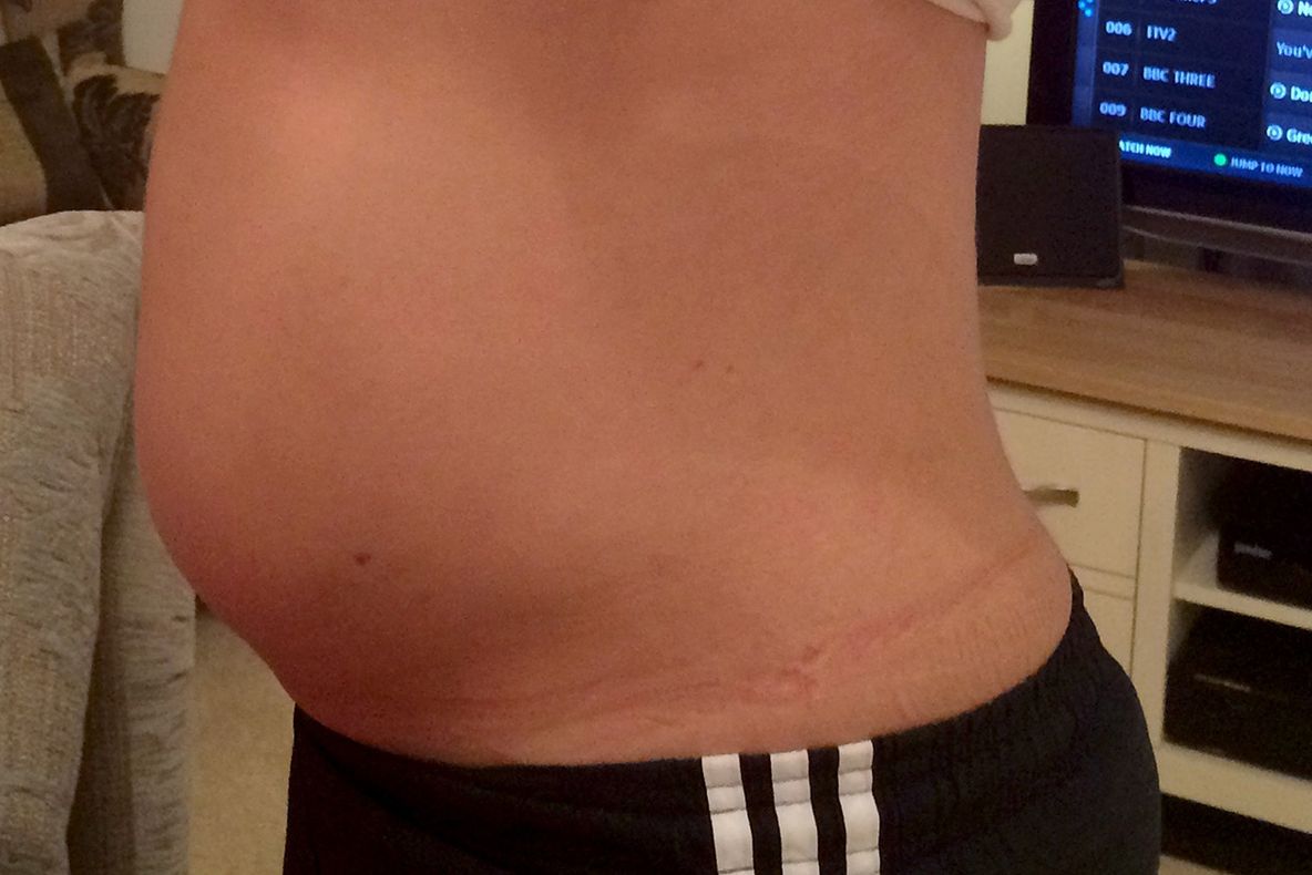 S-a dus la doctor, crezând că este însărcinată. Medicii au amuţit când i-au examinat abdomenul