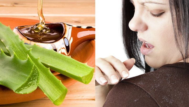 Remediu de iarnă: masca pentru păr făcută în casă care te scapă de mătreaţă