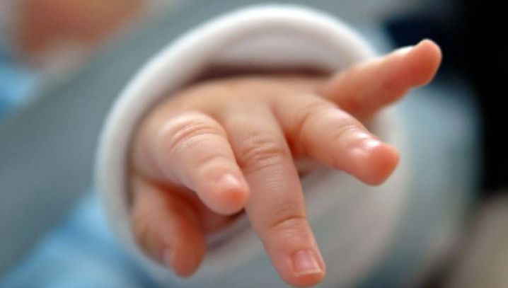 Siamezele născute la Constanţa se luptă să trăiască. Vor fi supuse astăzi mai multor investigaţii 