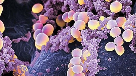 Ai aceste simptome? Mare atenţie! E STAFILOCOC auriu