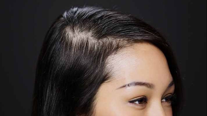 Avea părul foarte rar. L-a îndesit în 30 de zile folosind un singur ingredient