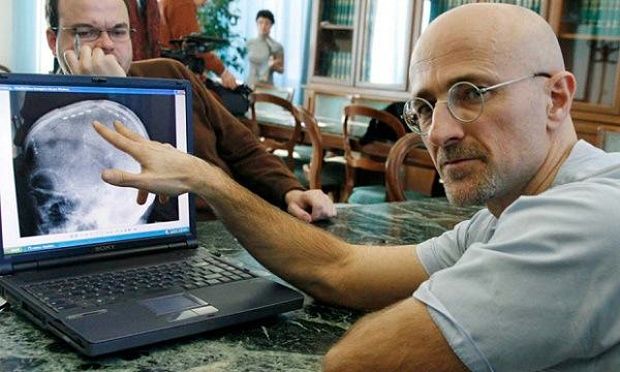 Operația care ar putea schimba cursul medicinei.Primul transplant de cap, un succes.Cine e pacientul