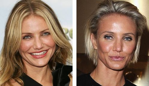 Vedete care şi-au făcut operaţii estice şi au regretat. Era mai bine înainte 