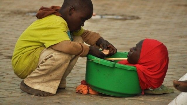 Povestea uluitoare a fetei care trăieşte fără corp: cazul său e unic în lume!