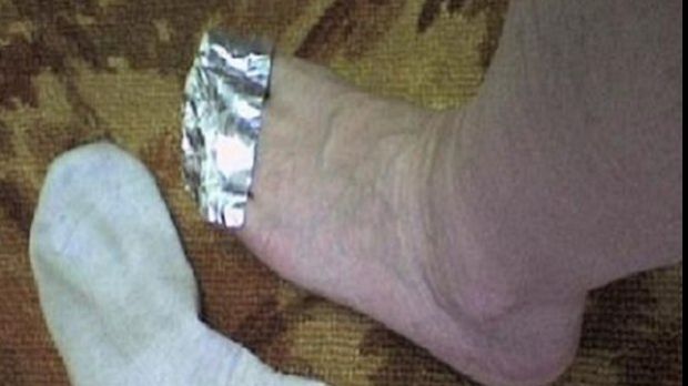 De ce e bine să-ţi pui folie de aluminiu pe degetele picioarelor. Efectul, peste așteptările tale