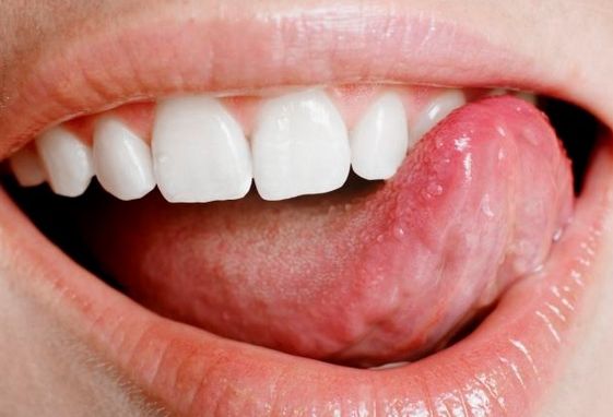 Ce spun petele de pe limbă despre starea ta de sănătate