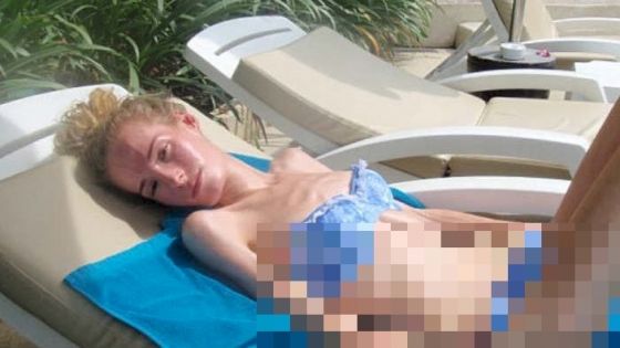 La 14 ani, cântărea 29 de kilograme şi era pe moarte. Cum arată după 7 ani de luptă cu boala 