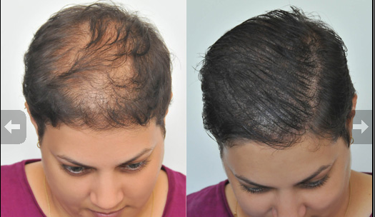 Se prepară cu ingrediente pe care le găsești în bucătărie.Remediul eficient pentru creșterea părului