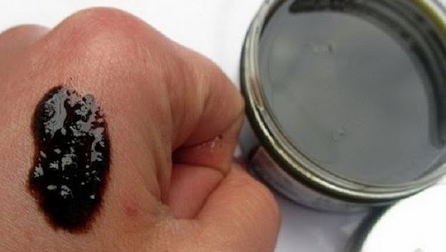 Singurul remediu de care ai nevoie pentru a te vindeca de psoriazis şi eczeme