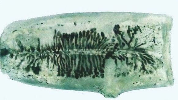 A mâncat carne crudă ani de zile şi s-a dus la medic cu dureri crunte. Doamne, ce i-au descoperit 