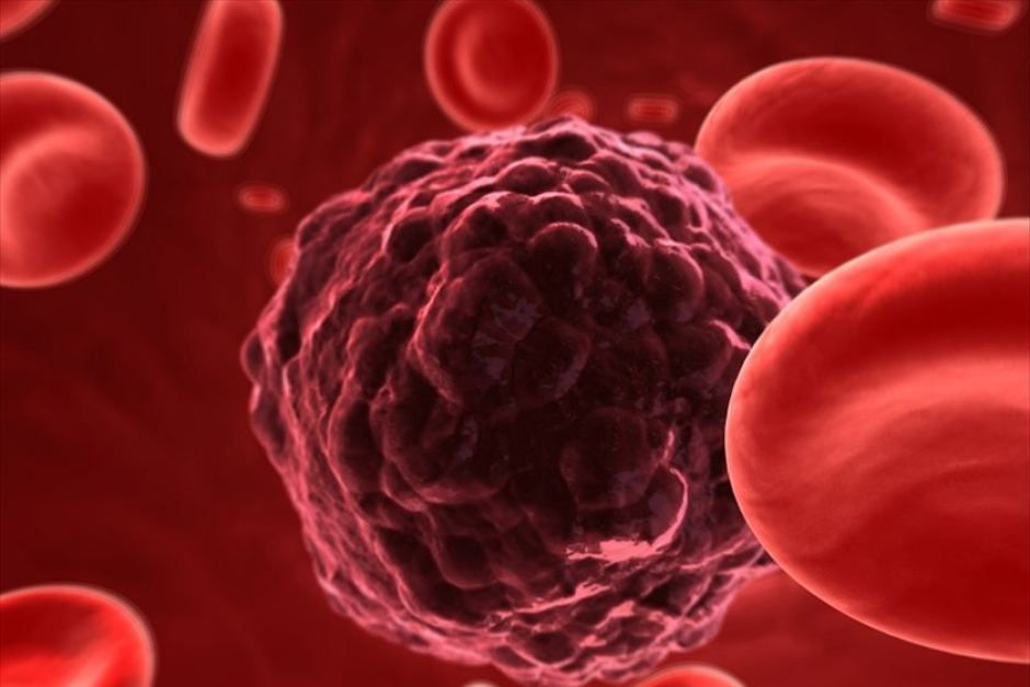 Cum arată fructele care ucid cancerul în doar un minut