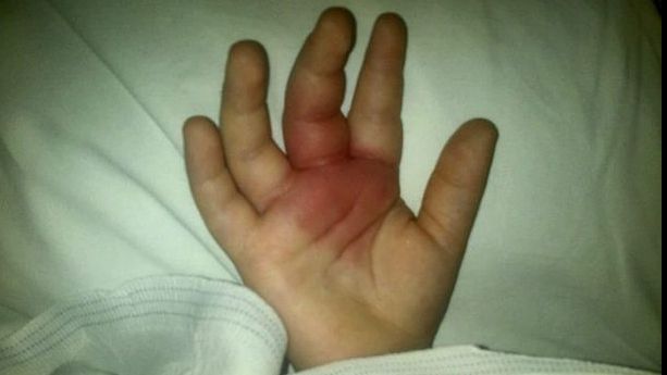 Copil paralizat, după ce a mâncat un fruct pe care toți micuții îl consumă