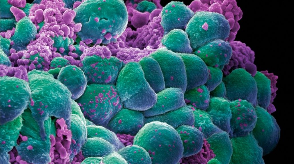 Leguma care distruge celulele canceroase. Cum se consumă