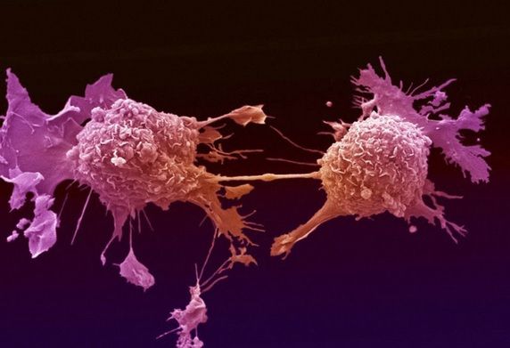 Au revoluţionat lumea întreagă! Cum arată fructele care ucid cancerul într-un minut