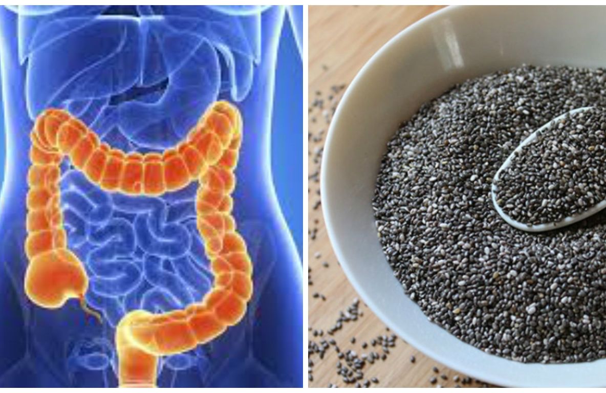 Probabil cel mai bun remediu natural pentru cancerul de colon. Din păcate, puțină lume îl știe