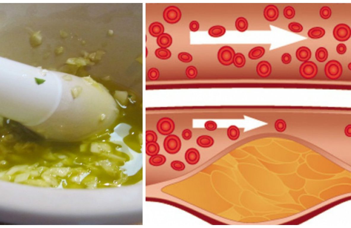 Această băutură tămăduitoare destupă vasele inimii și te ferește de probleme cardiace