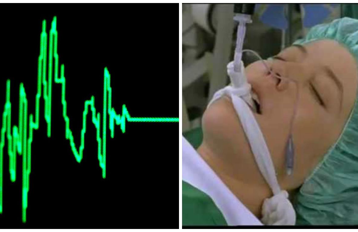 Ce a aflat un om după ce și-a deconectat soţia de la aparate. La 3 zile a primit vestea șocantă