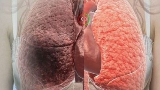 Cum să-ți cureți plămânii în doar trei zile. Simplu și rapid, cu aceste sucuri magice