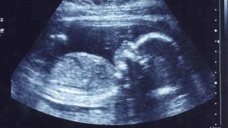 La ecografie, medicul i-a dat o veste cumplită despre bebeluş. Apoi, o minune s-a petrecut