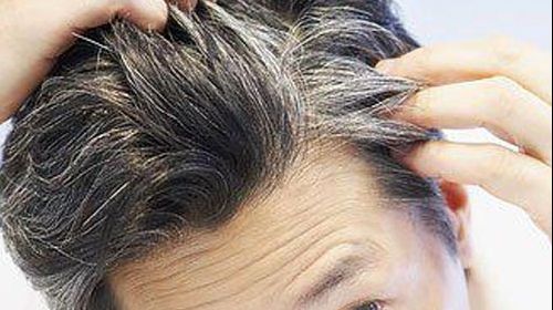 Poți scăpa de părul alb cu ajutorul unui singur ingredient