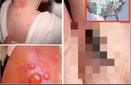 Mergeți imediat la medic dacă vedeți acest gândac în casă. Este foarte periculos pentru sănătate