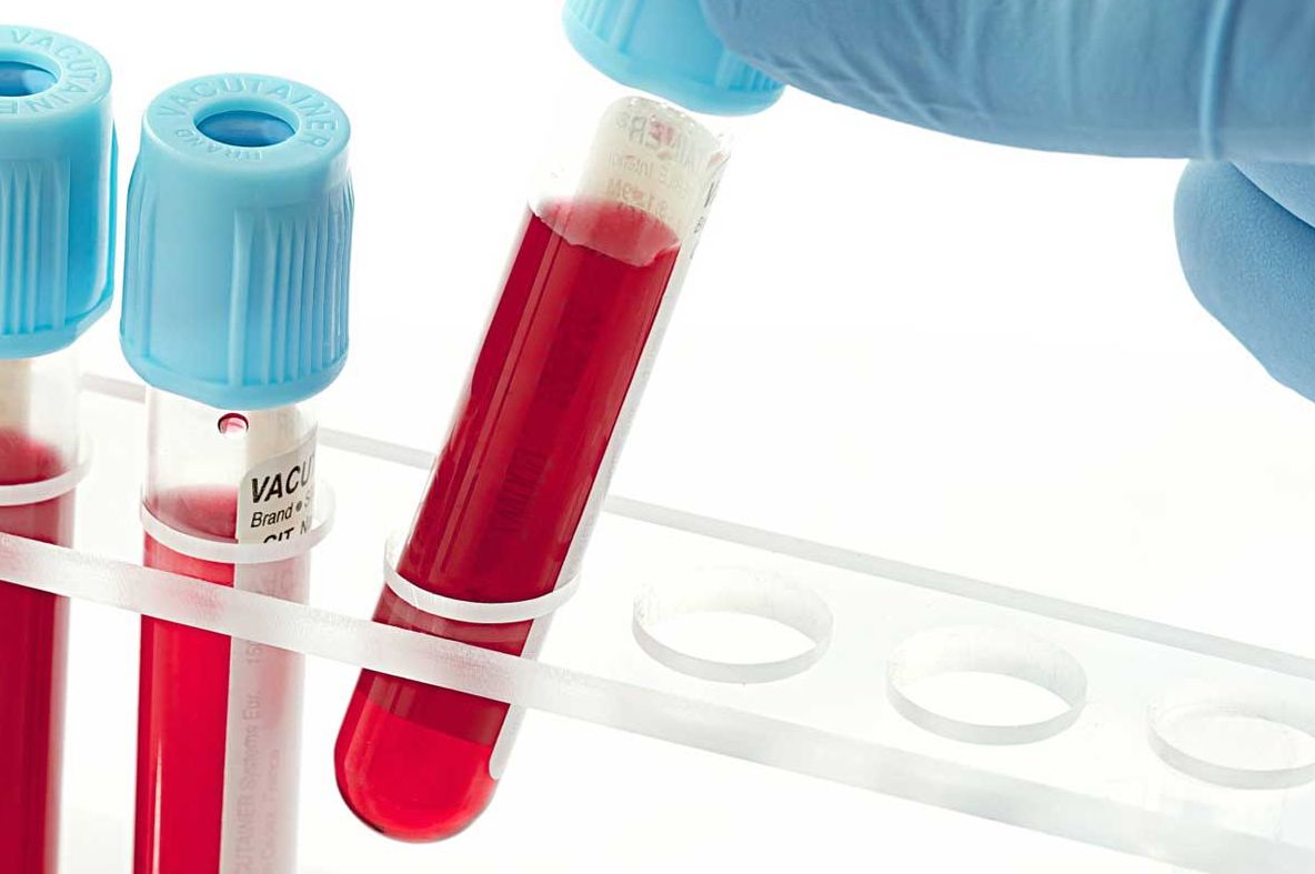 Grupa de sânge îţi influenţează sănătatea. Iată cum!