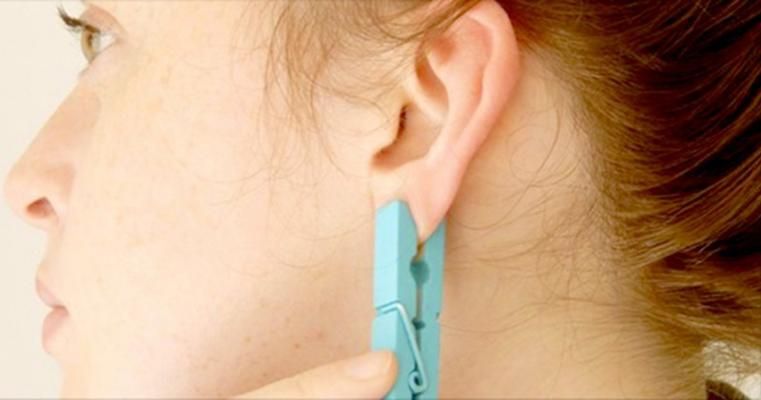 Și-a prins de ureche un clește de rufe. Explicația pe care a dat-o te va lăsa fără cuvinte