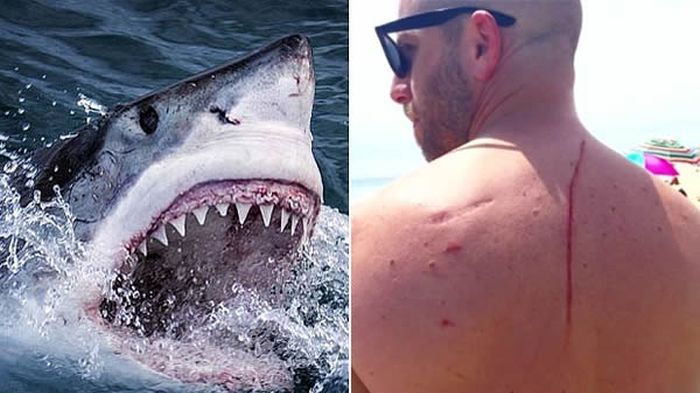 A fost atacat de un rechin. Motivul pentru care s-a bucurat că a fost mușcat îngrozitor