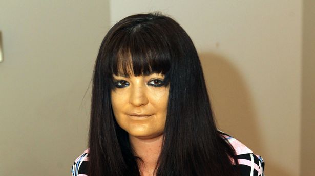 A stat jumătate de oră la solar. Când a ieşit s-a îngrozit 