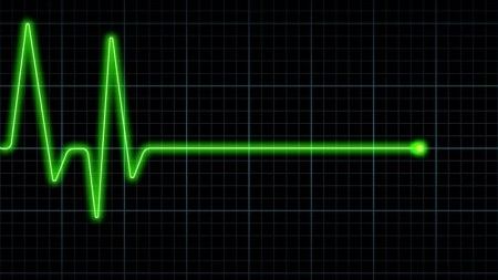 "Moartea este reversibilă". Explicația unui specialist american