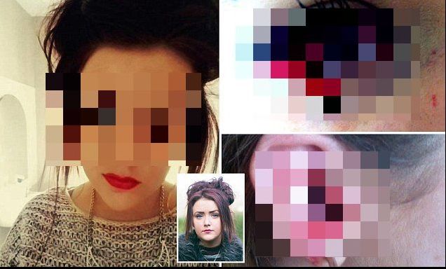 Drama tinerei care sângerează pe ochi și pe urechi. Niciun doctor nu-și poate explica misterul