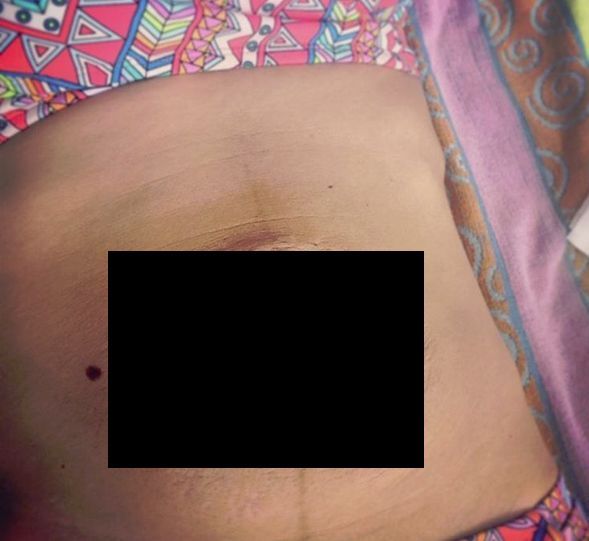 Imagini dure. O atletă îşi arată corpul după două sarcini 