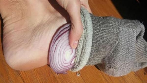 A pus ceapă în șosete înainte de culcare. Efectul asupra organismului s-a simțit imediat
