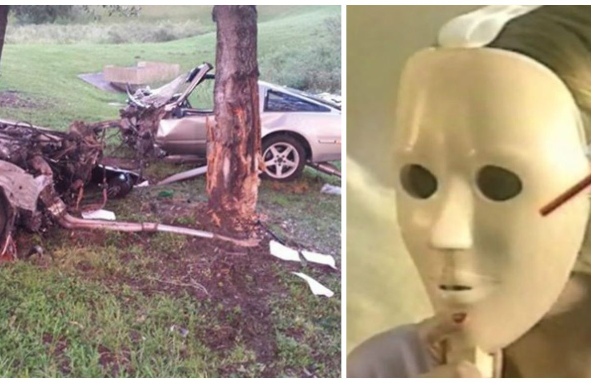 Un accident monstruos i-a zdrobit trupul. La operație, doctorii i-au decopertat fața. Cum arată acum